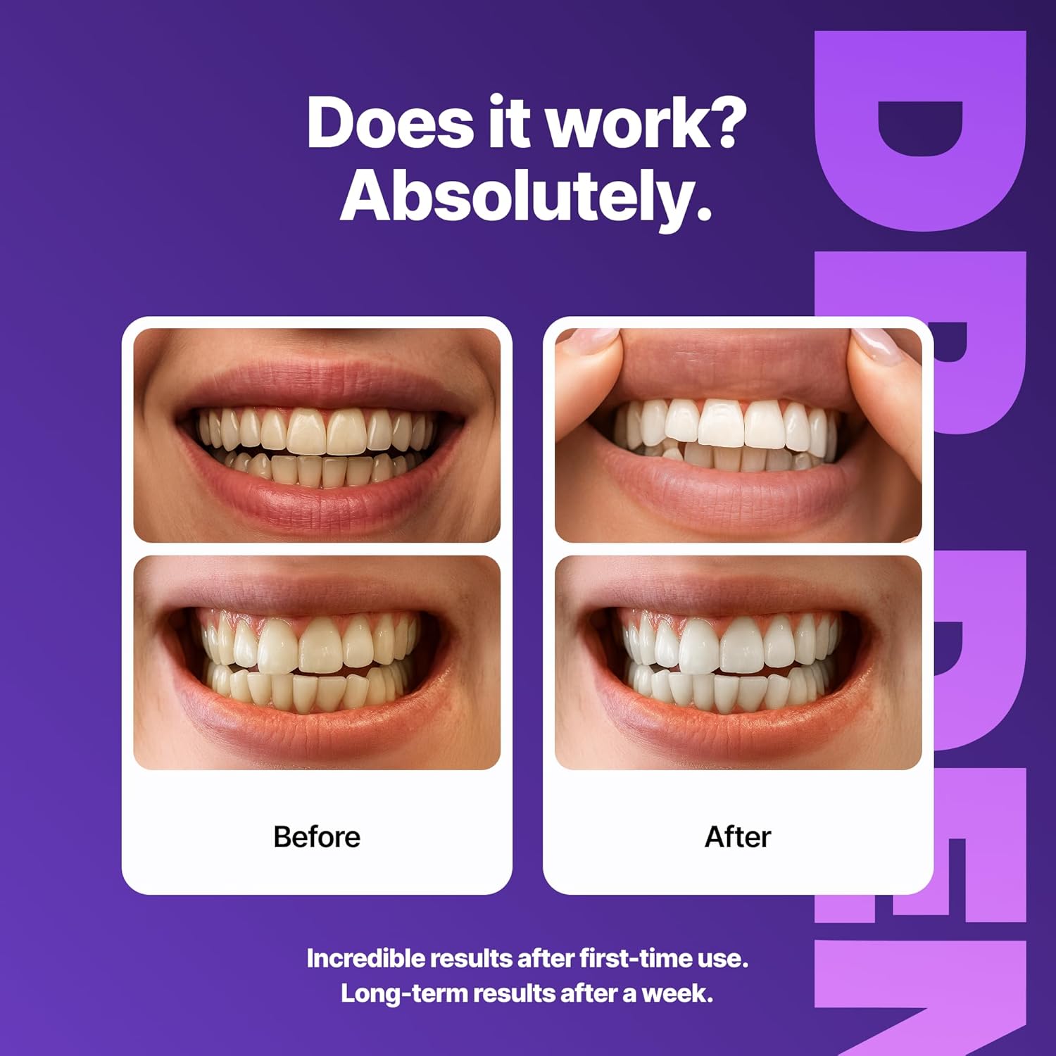 Professional Teeth Whitening Strips